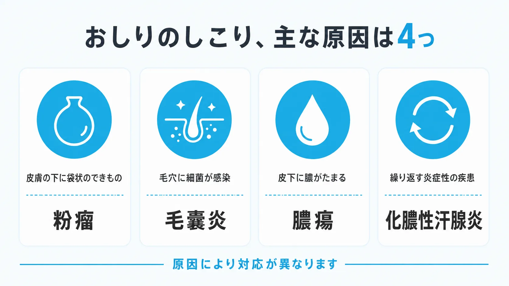 おしりにしこりができる主な原因4つ(粉瘤・毛嚢炎・膿瘍・化膿性汗腺炎)を示すインフォグラフィック