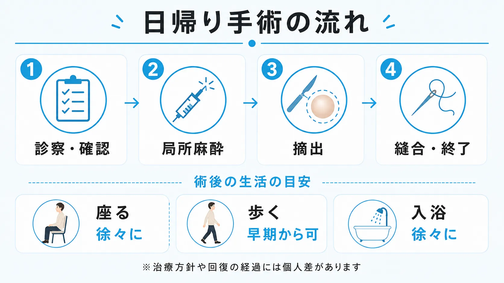 粉瘤の日帰り手術の流れと術後の生活目安を示すインフォグラフィック