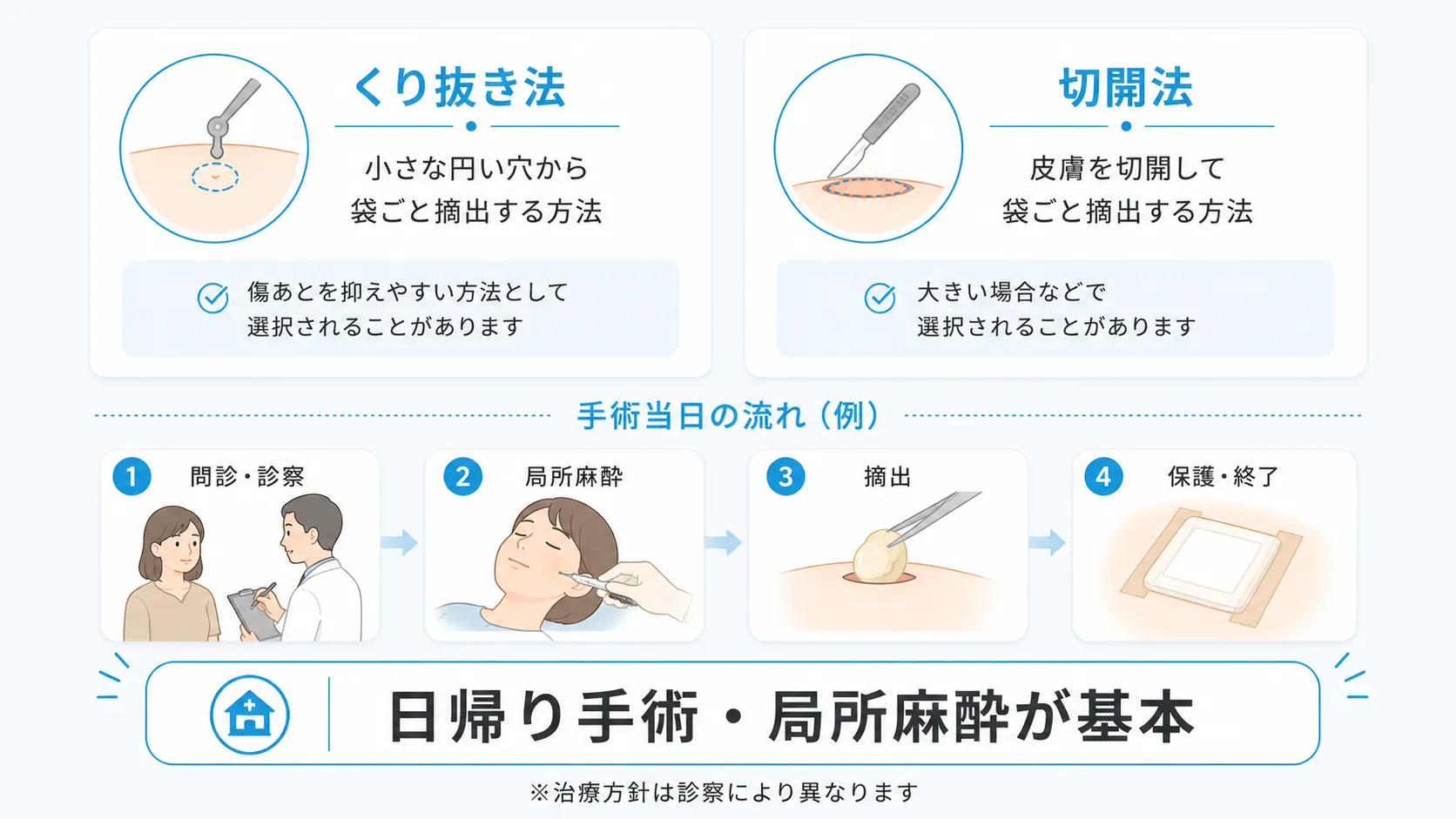 くり抜き法と切開法、手術当日の流れを示すインフォグラフィック