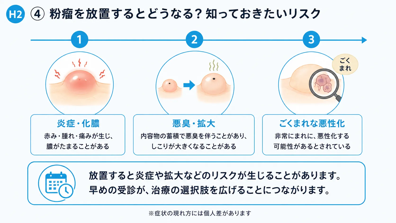 粉瘤を放置した場合のリスクを示すインフォグラフィック。炎症・拡大・ごくまれな悪性化を時系列で解説。