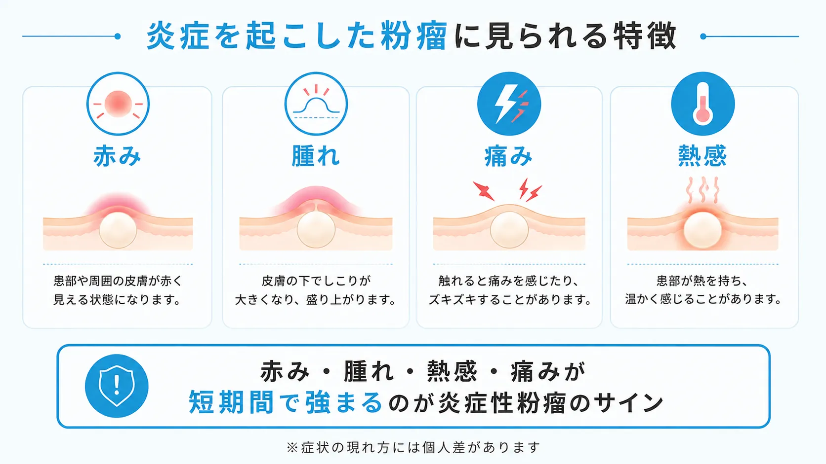 炎症を起こした粉瘤に見られる特徴 炎症性粉瘤に見られる赤み・腫れ・痛み・熱感の特徴をまとめたインフォグラフィック