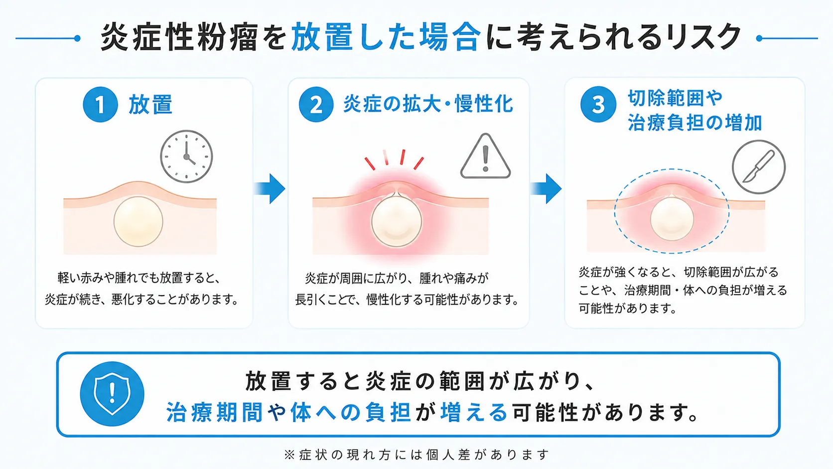 炎症性粉瘤を放置した場合に考えられるリスク 炎症性粉瘤を放置した場合のリスクを段階的に示したインフォグラフィック