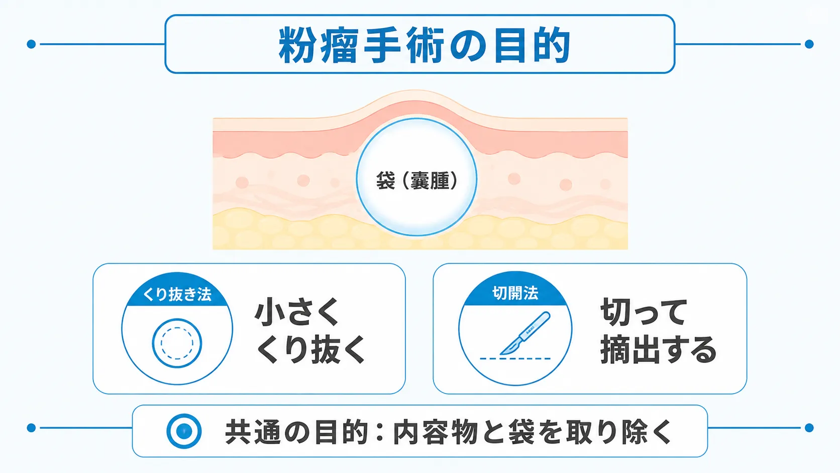 くり抜き法と切開法、それぞれの摘出方法の違いを示した図解