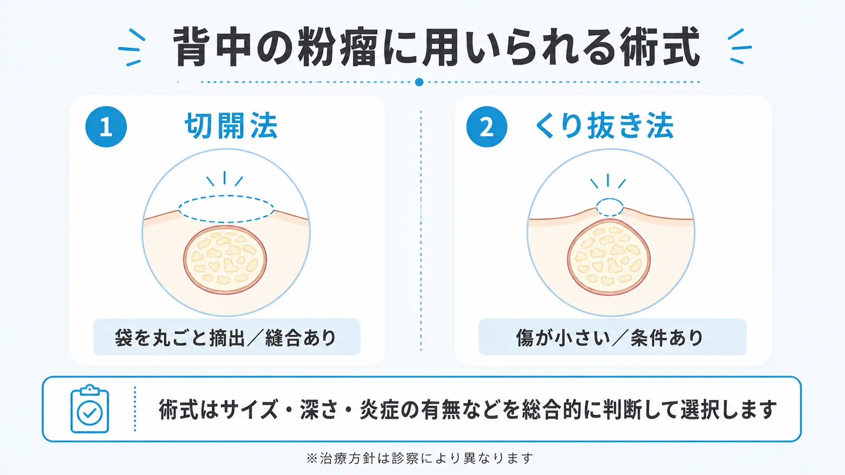 切開法とくり抜き法の特徴を比較するインフォグラフィック