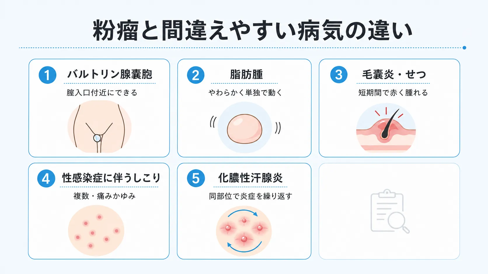 粉瘤と間違えやすい5つの病気の特徴を比較したイラスト