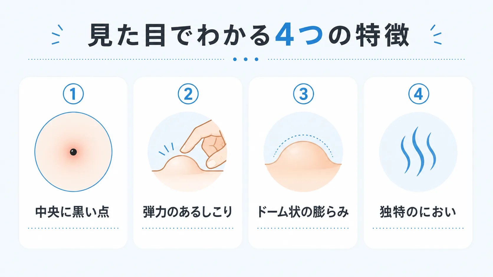 粉瘤の見た目の4つの特徴(黒い点・弾力・ドーム状の膨らみ・におい)をまとめた図解