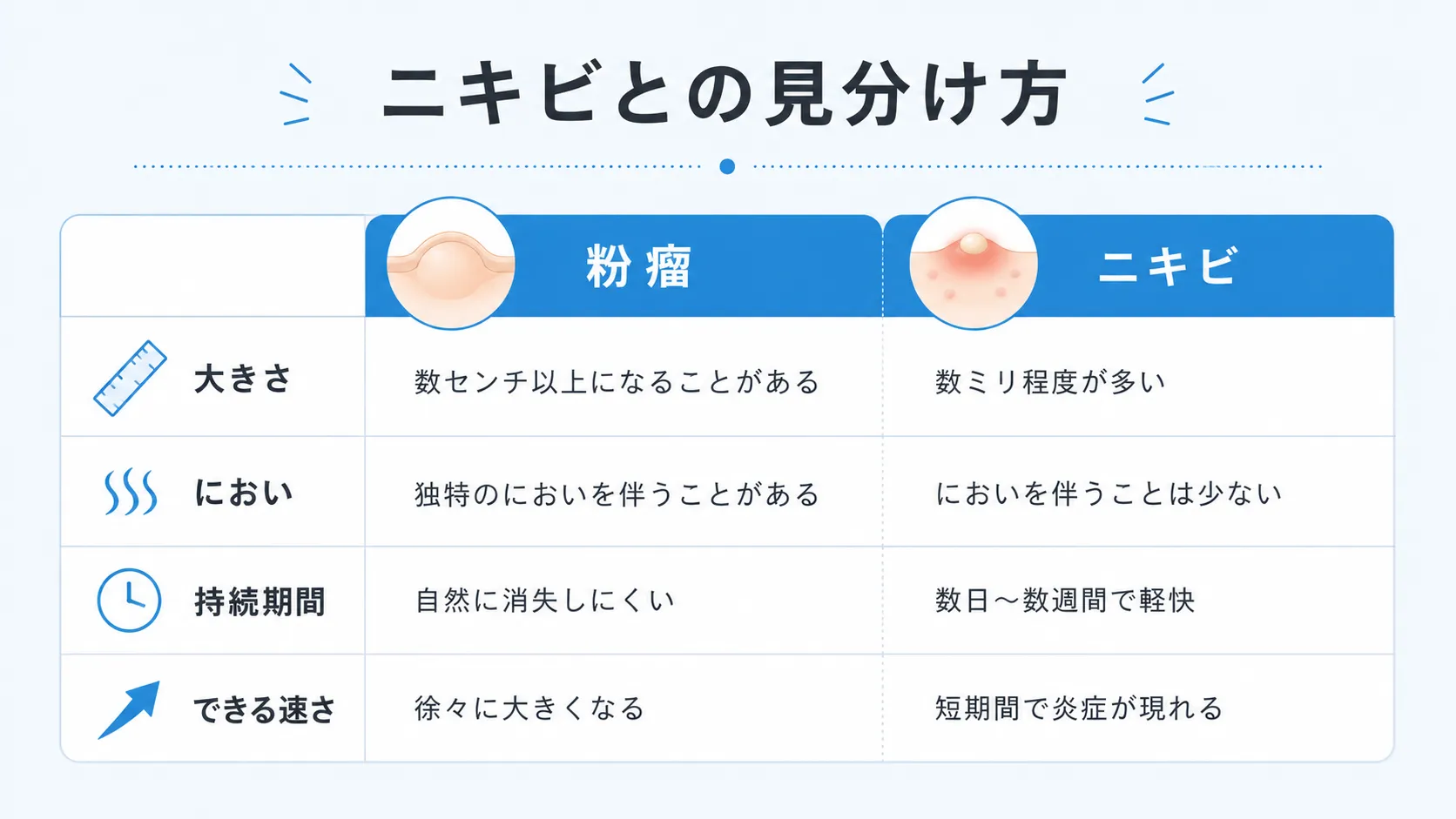 粉瘤とニキビの大きさ・におい・持続期間・できる速さの違いを比較した図解