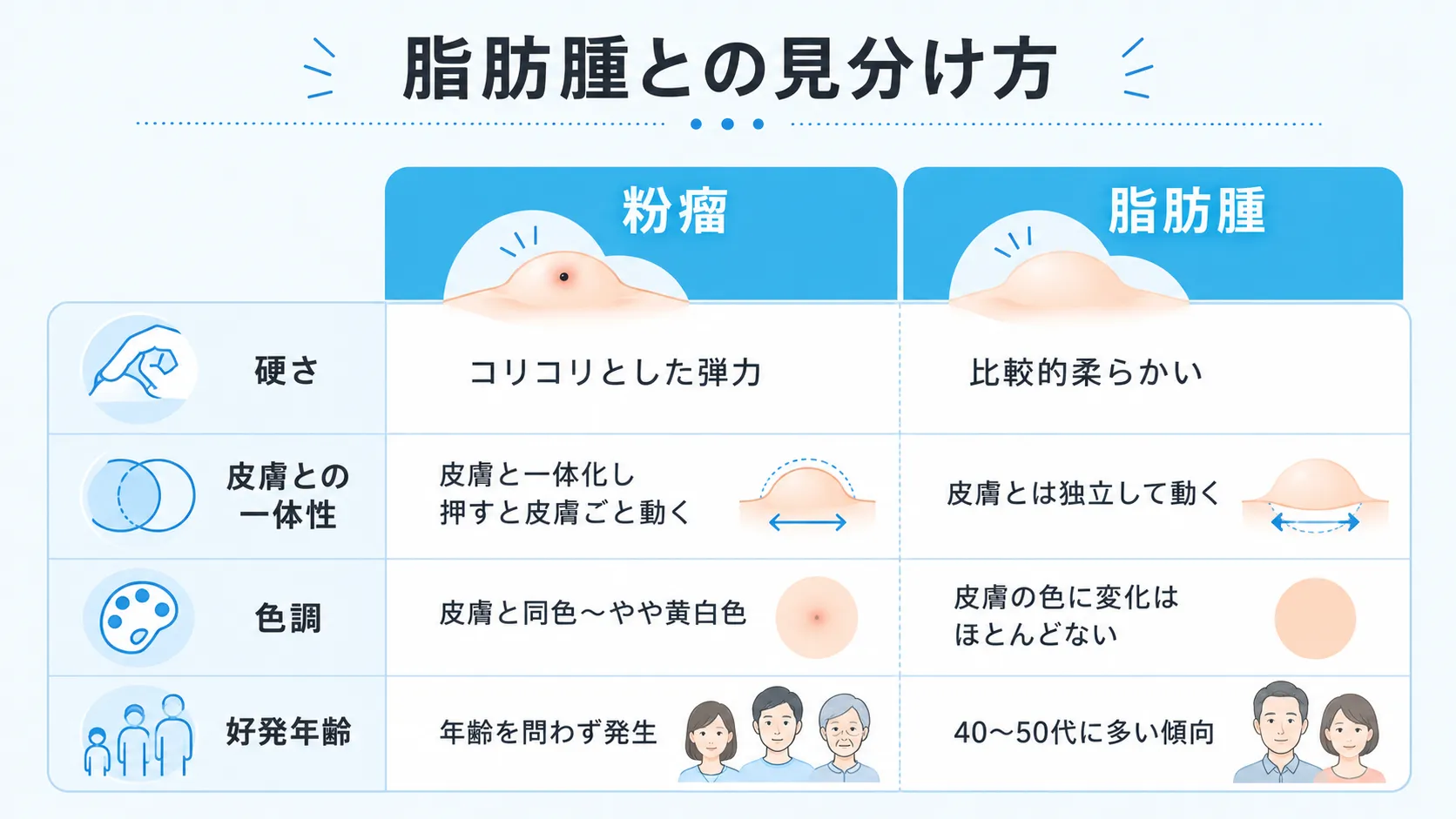 粉瘤と脂肪腫の硬さ・皮膚との一体性・色調・好発年齢の違いを比較した図解