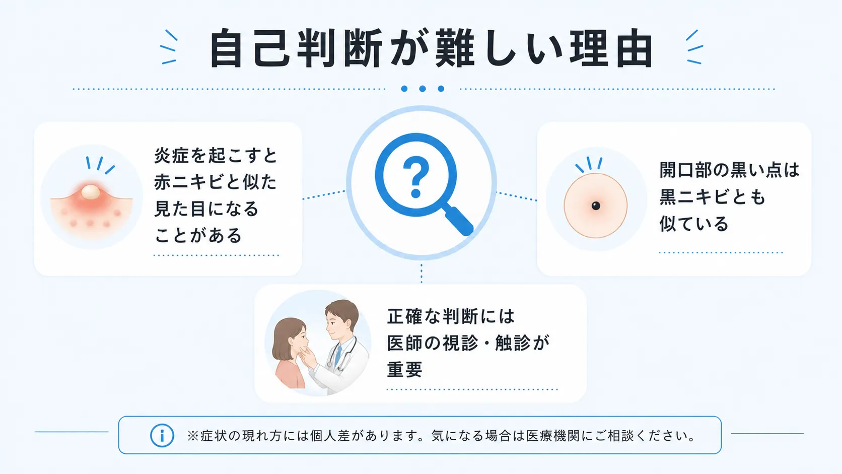 炎症を起こした粉瘤がニキビと見分けにくくなる理由をまとめた図解
