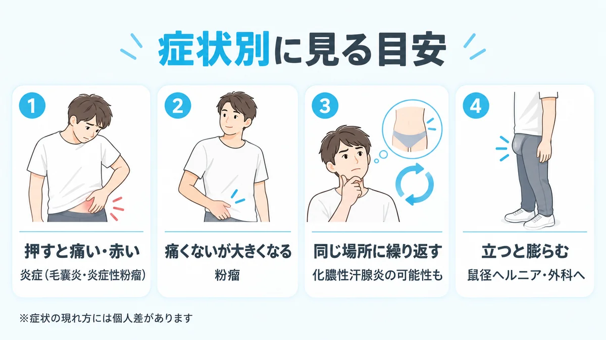 押すと痛い・痛くないが大きくなる・繰り返す・立つと膨らむの4つの症状別に考えられる原因を示した図解