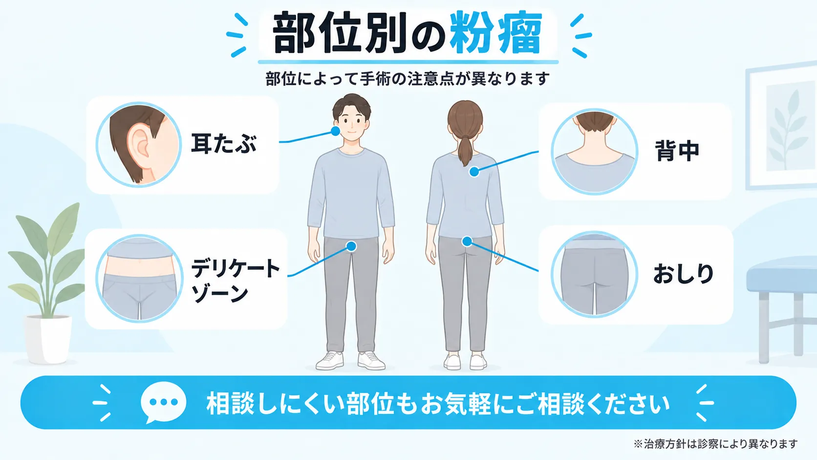 耳たぶ・背中・おしり・デリケートゾーンの粉瘤の部位を人体シルエットで示した図