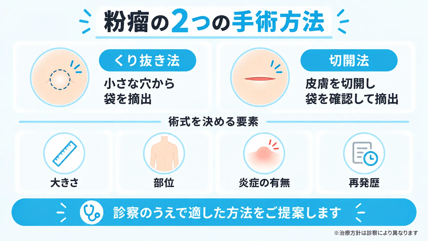 くり抜き法と切開法の概要と術式を決める4つの要素を示した図