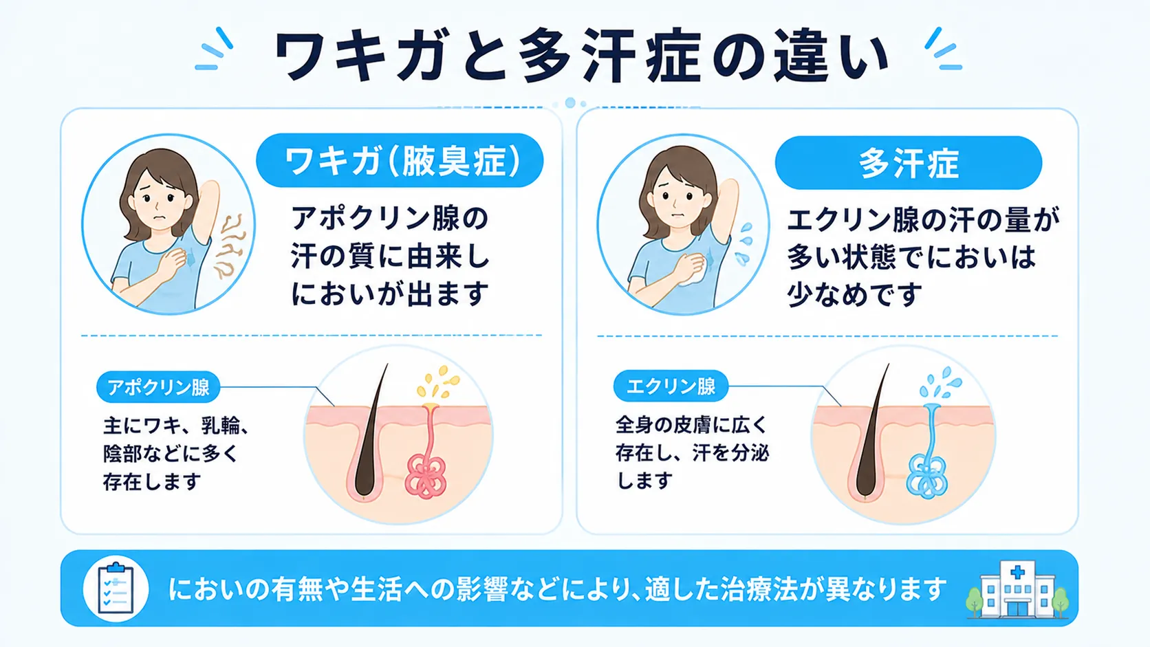 ワキガはアポクリン腺の汗の質に由来してにおいが生じ、多汗症はエクリン腺の汗の量が多い状態であるという両者の違いを整理したインフォグラフィック