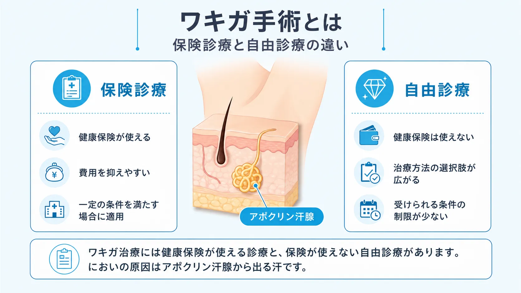 ワキガ治療には健康保険が適用される保険診療と、保険が適用されない自由診療があることを左右のカードで比較したインフォグラフィック。においの原因がアポクリン汗腺から出る汗であることも示しています。